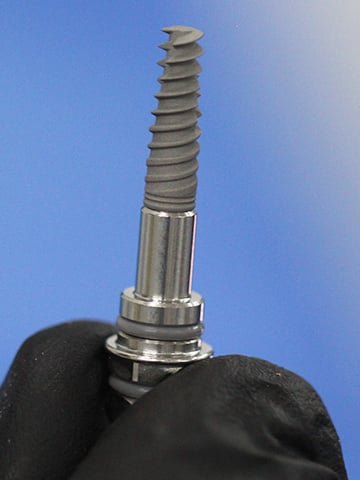 Hospital de Dientes Implantes