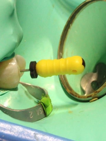 Hospital de Dientes Endodoncia